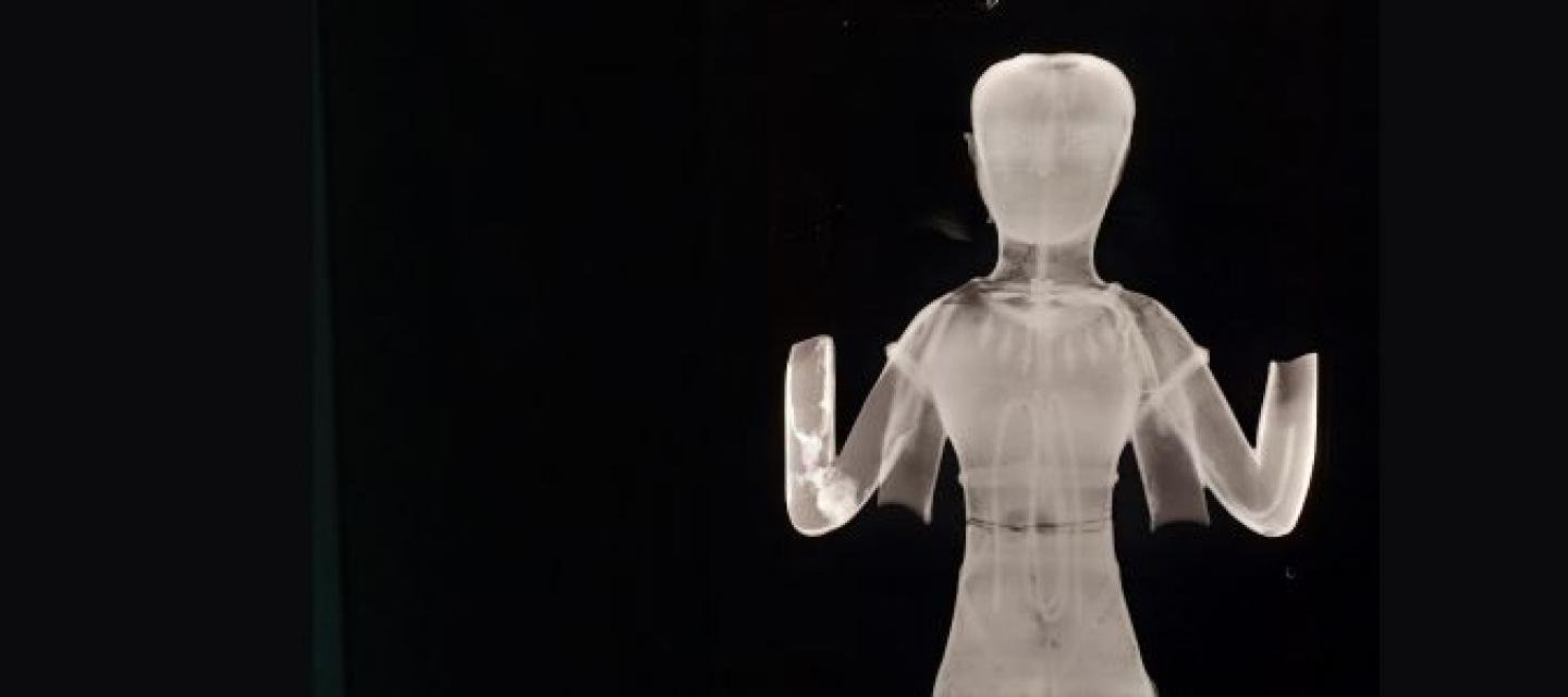 Radiographie d'un bronze