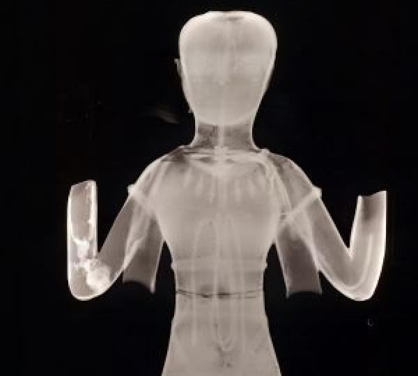 Radiographie d'un bronze